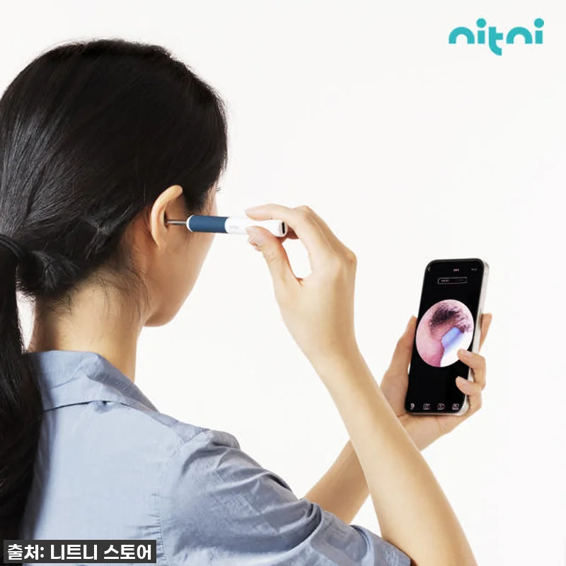 이슈템 떴다! 니트니 귀내시경, 무선 관련 이미지 1