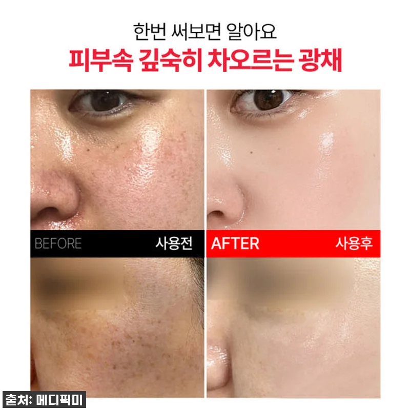 메디픽미 콜라겐 PDRN 더블 비타민 관련 이미지 3