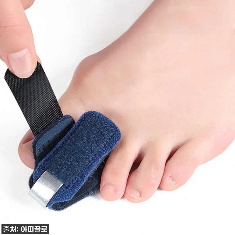 발편한게 최고! '엄지발가락 보호대' 관련 이미지 1