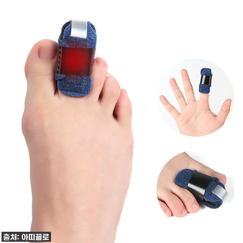 발편한게 최고! '엄지발가락 보호대' 관련 이미지 7