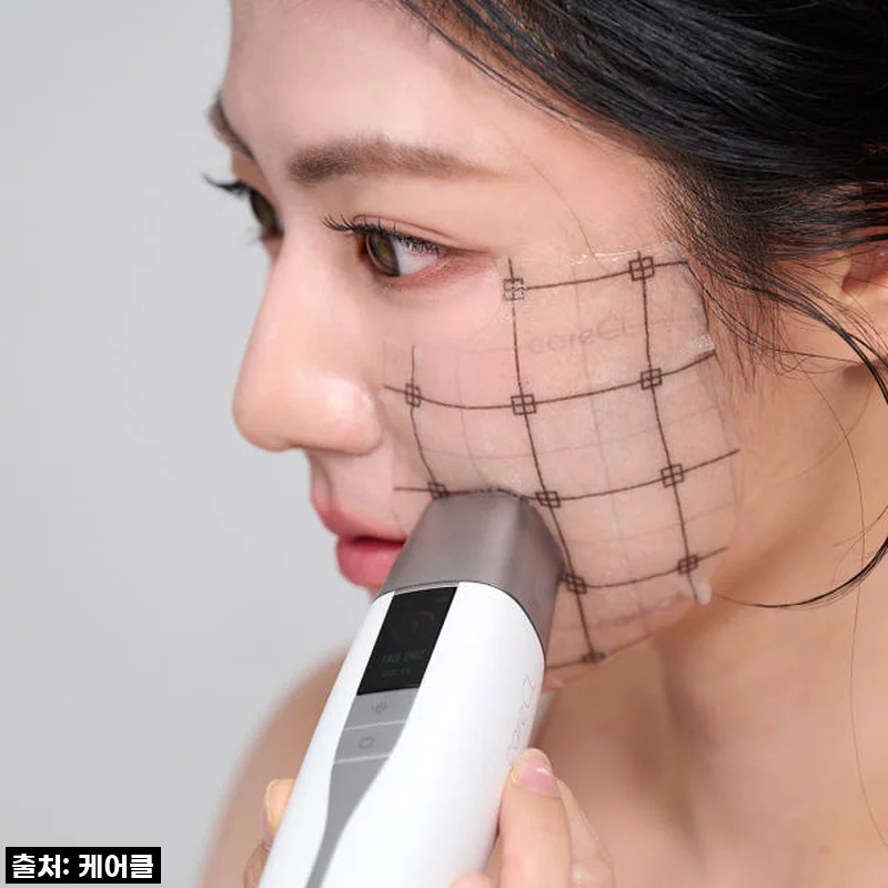 피부과 이제 안녕? 써마지 장인이 만든 케어클 테크핏, 직접 써보니 이런 변화가!