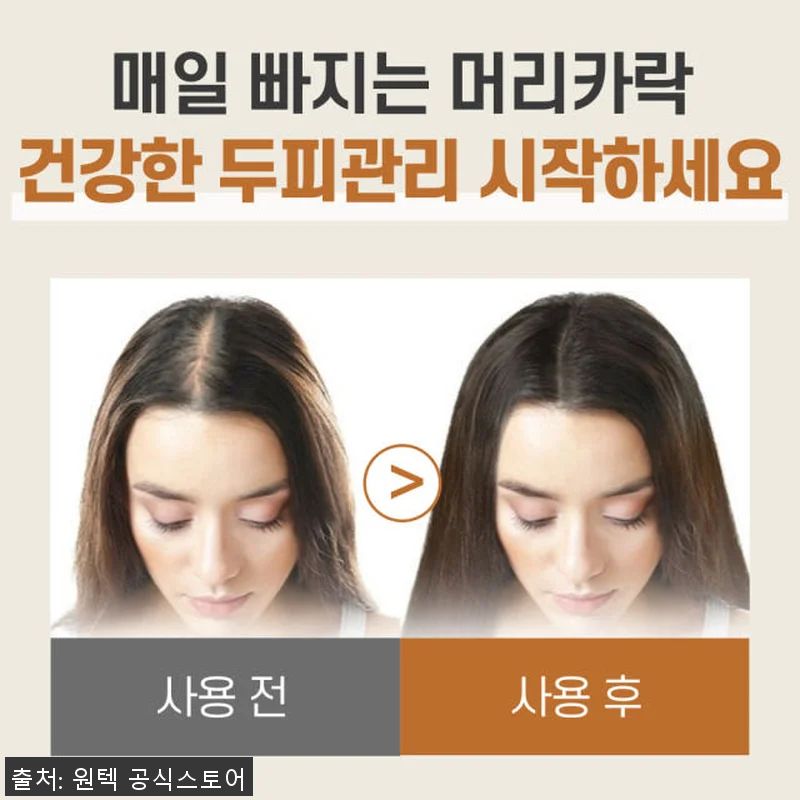 헤어뱅 두피 관리기 사용후기: 꾸준한 관련 이미지 6