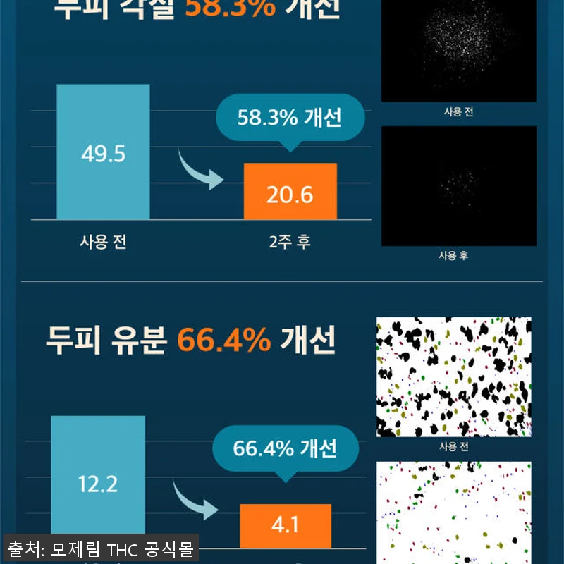 모제림 엘릭서 탈모샴푸세트 300ml 관련 이미지 6