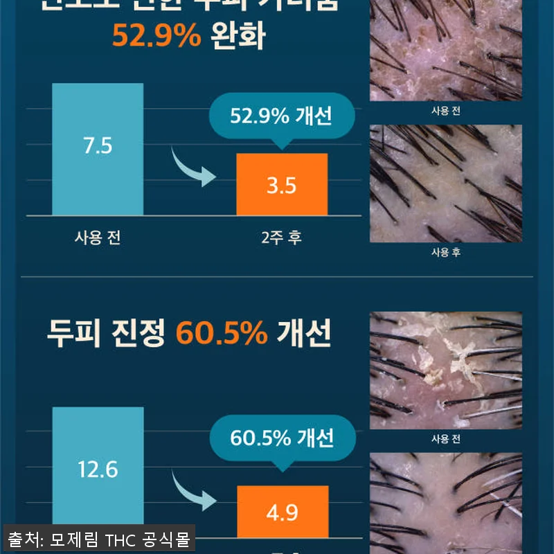 모제림 엘릭서 탈모샴푸세트 300ml 관련 이미지 8