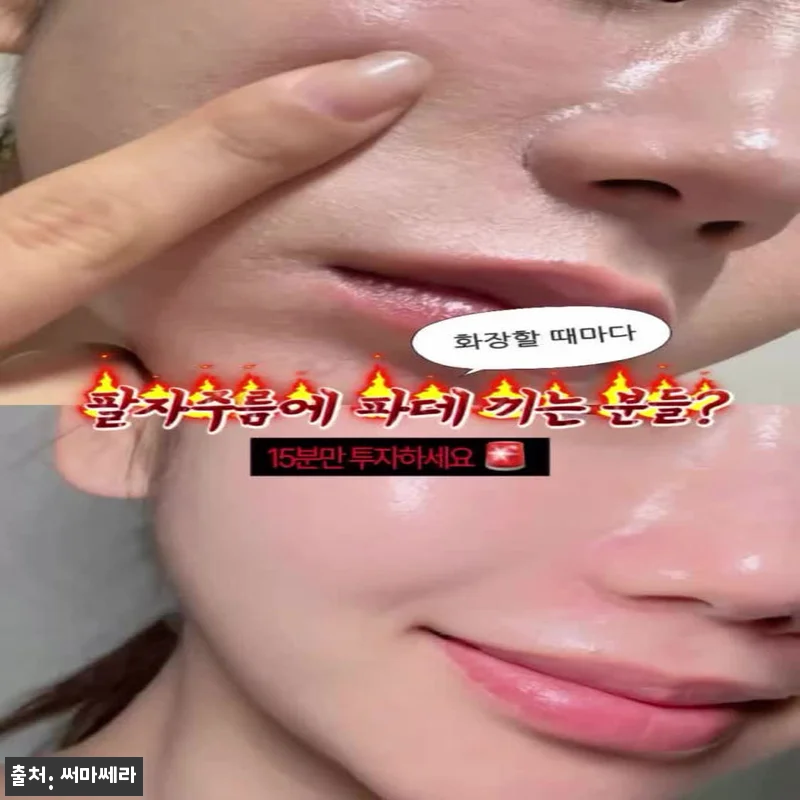 써마쎄라 페이스튠 찐후기, 크라이오· 관련 이미지 7